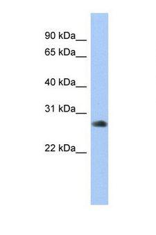 ZNF763 Antibody - Western blot of Human HepG2. ZNF763 antibody dilution 1.0 ug/ml.  This image was taken for the unconjugated form of this product. Other forms have not been tested.