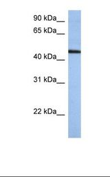 ZNF766 Antibody - Hela cell lysate. Antibody concentration: 1.0 ug/ml. Gel concentration: 12%.  This image was taken for the unconjugated form of this product. Other forms have not been tested.
