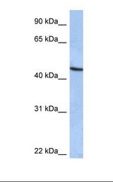 ZNF766 Antibody - Hela cell lysate. Antibody concentration: 1.0 ug/ml. Gel concentration: 12%.  This image was taken for the unconjugated form of this product. Other forms have not been tested.