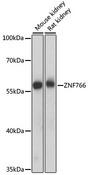 ZNF766 Antibody - Western blot analysis of extracts of various cell lines using ZNF766 Polyclonal Antibody at dilution of 1:1000.