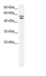 ZNF768 Antibody - HepG2 Cell Lysate.  This image was taken for the unconjugated form of this product. Other forms have not been tested.