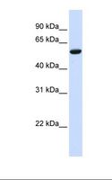 ZNF77 Antibody - Hela cell lysate. Antibody concentration: 1.0 ug/ml. Gel concentration: 12%.  This image was taken for the unconjugated form of this product. Other forms have not been tested.