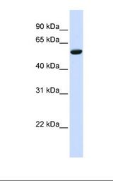 ZNF77 Antibody - Hela cell lysate. Antibody concentration: 1.0 ug/ml. Gel concentration: 12%.  This image was taken for the unconjugated form of this product. Other forms have not been tested.