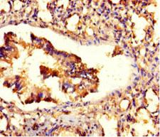 ZNF77 Antibody - Immunohistochemistry of paraffin-embedded human lung tissue using ZNF77 Antibody at dilution of 1:100