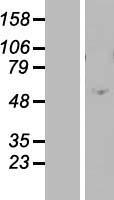 ZNF770 Protein - Western validation with an anti-DDK antibody * L: Control HEK293 lysate R: Over-expression lysate
