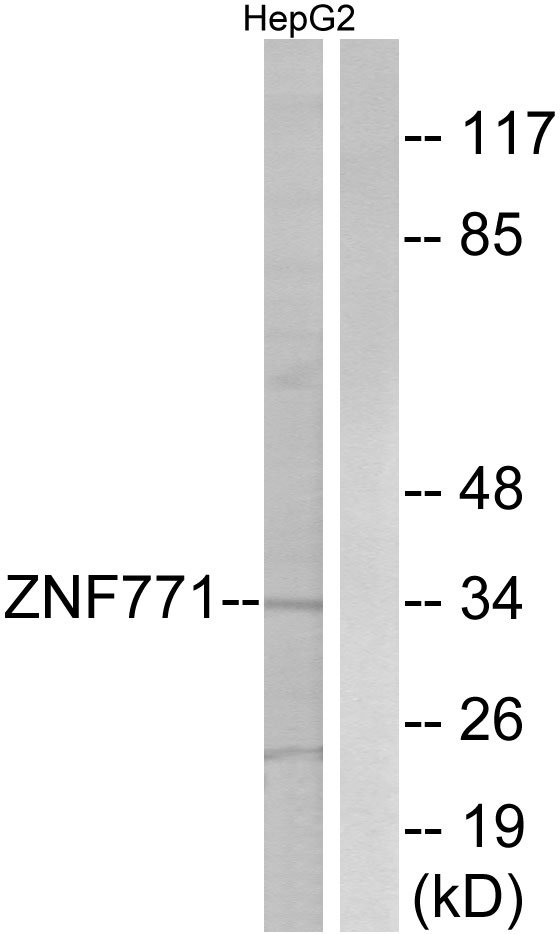 ZNF771 Antibody - Western blot analysis of lysates from HepG2 cells, using ZNF771 Antibody. The lane on the right is blocked with the synthesized peptide.