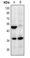 ZNF771 Antibody - Western blot analysis of ZNF771 expression in HepG2 (A), HEK293T (B) whole cell lysates.