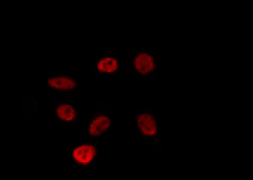 ZNF771 Antibody - Staining HepG2 cells by IF/ICC. The samples were fixed with PFA and permeabilized in 0.1% Triton X-100, then blocked in 10% serum for 45 min at 25°C. The primary antibody was diluted at 1:200 and incubated with the sample for 1 hour at 37°C. An Alexa Fluor 594 conjugated goat anti-rabbit IgG (H+L) Ab, diluted at 1/600, was used as the secondary antibody.