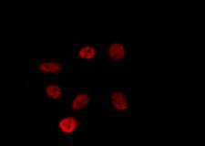 ZNF771 Antibody - Staining HepG2 cells by IF/ICC. The samples were fixed with PFA and permeabilized in 0.1% Triton X-100, then blocked in 10% serum for 45 min at 25°C. The primary antibody was diluted at 1:200 and incubated with the sample for 1 hour at 37°C. An Alexa Fluor 594 conjugated goat anti-rabbit IgG (H+L) Ab, diluted at 1/600, was used as the secondary antibody.