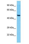ZNF772 Antibody - ZNF772 antibody Western Blot of HepG2. Antibody dilution: 1 ug/ml.  This image was taken for the unconjugated form of this product. Other forms have not been tested.