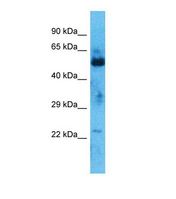 ZNF772 Antibody - Western blot of Human Thymus Tumor. ZNF772 antibody dilution 1.0 ug/ml.  This image was taken for the unconjugated form of this product. Other forms have not been tested.
