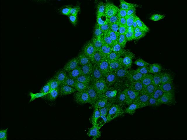 ZNF772 Antibody - Immunofluorescence staining of ZNF772 in A431 cells. Cells were fixed with 4% PFA, permeabilzed with 0.1% Triton X-100 in PBS, blocked with 10% serum, and incubated with rabbit anti-Human ZNF772 polyclonal antibody (dilution ratio 1:200) at 4°C overnight. Then cells were stained with the Alexa Fluor 488-conjugated Goat Anti-rabbit IgG secondary antibody (green) and counterstained with DAPI (blue). Positive staining was localized to Cytoplasm.