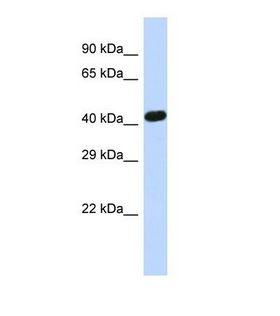 ZNF773 Antibody - Western blot of Human HeLa. ZNF773 antibody dilution 1.0 ug/ml.  This image was taken for the unconjugated form of this product. Other forms have not been tested.
