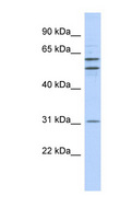 ZNF775 Antibody - ZNF775 antibody Western blot of HeLa lysate. This image was taken for the unconjugated form of this product. Other forms have not been tested.