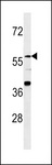 ZNF776 Antibody - ZNF776 Antibody western blot of A2058 cell line lysates (35 ug/lane). The ZNF776 Antibody detected the ZNF776 protein (arrow).