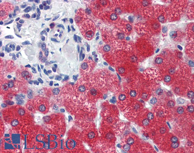 ZNF777 Antibody - Human Liver (formalin-fixed, paraffin-embedded) stained with ZNF777 antibody LS-B3591 followed by biotinylated goat anti-rabbit IgG secondary antibody, alkaline phosphatase-streptavidin and chromogen.  This image was taken for the unconjugated form of this product. Other forms have not been tested.