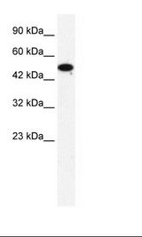 ZNF778 Antibody - HepG2 Cell Lysate.  This image was taken for the unconjugated form of this product. Other forms have not been tested.