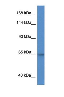 ZNF780A Antibody - ZNF780A antibody Western blot of HepG2 Cell lysate. Antibody concentration 1 ug/ml.  This image was taken for the unconjugated form of this product. Other forms have not been tested.