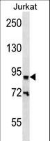 ZNF780B Antibody - ZNF780B Antibody western blot of Jurkat cell line lysates (35 ug/lane). The ZNF780B antibody detected the ZNF780B protein (arrow).