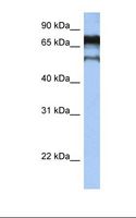ZNF780B Antibody - Hela cell lysate. Antibody concentration: 1.0 ug/ml. Gel concentration: 12%.  This image was taken for the unconjugated form of this product. Other forms have not been tested.