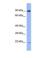 ZNF780B Antibody - Western blot of Human ACHN. ZNF780B antibody dilution 1.0 ug/ml.  This image was taken for the unconjugated form of this product. Other forms have not been tested.