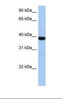 ZNF781 Antibody - Fetal muscle lysate. Antibody concentration: 1.0 ug/ml. Gel concentration: 12%.  This image was taken for the unconjugated form of this product. Other forms have not been tested.