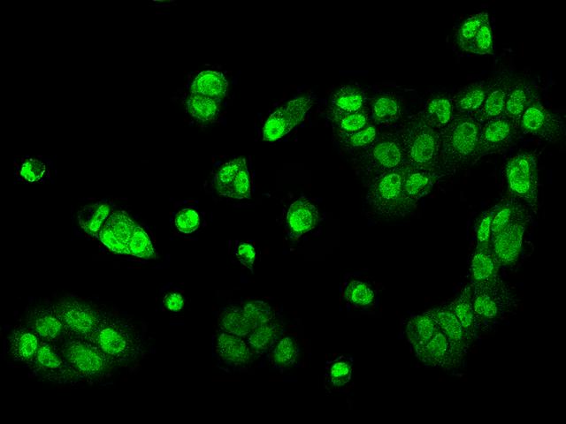 ZNF782 Antibody - Immunofluorescence staining of ZNF782 in A431 cells. Cells were fixed with 4% PFA, permeabilzed with 0.1% Triton X-100 in PBS, blocked with 10% serum, and incubated with rabbit anti-Human ZNF782 polyclonal antibody (dilution ratio 1:200) at 4°C overnight. Then cells were stained with the Alexa Fluor 488-conjugated Goat Anti-rabbit IgG secondary antibody (green). Positive staining was localized to Nucleus.