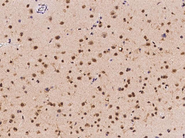 ZNF782 Antibody - Immunochemical staining of human ZNF782 in human brain with rabbit polyclonal antibody at 1:2000 dilution, formalin-fixed paraffin embedded sections.
