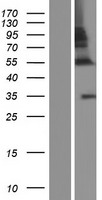 ZNF783 Protein - Western validation with an anti-DDK antibody * L: Control HEK293 lysate R: Over-expression lysate