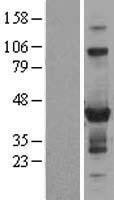 ZNF784 Protein - Western validation with an anti-DDK antibody * L: Control HEK293 lysate R: Over-expression lysate