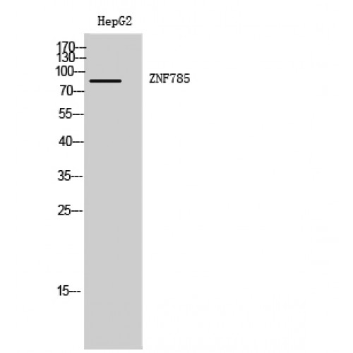 ZNF785 Antibody - Western blot of ZNF785 antibody