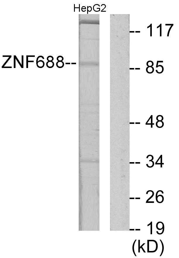 ZNF785 Antibody - Western blot analysis of lysates from HepG2 cells, using ZNF785 Antibody. The lane on the right is blocked with the synthesized peptide.