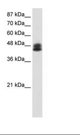 ZNF785 Antibody - Transfected 293T Cell Lysate.  This image was taken for the unconjugated form of this product. Other forms have not been tested.