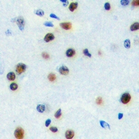 ZNF785 Antibody - Immunohistochemical analysis of ZNF785 staining in human brain formalin fixed paraffin embedded tissue section. The section was pre-treated using heat mediated antigen retrieval with sodium citrate buffer (pH 6.0). The section was then incubated with the antibody at room temperature and detected with HRP and DAB as chromogen. The section was then counterstained with hematoxylin and mounted with DPX.