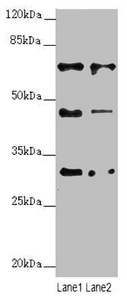 ZNF785 Antibody - Western blot All Lanes:ZNF785 antibody at 6.27ug/ml Lane 1 : Hela whole cell lysate Lane 2 : PC-3 whole cell lysate Secondary Goat polyclonal to Rabbit IgG at 1/10000 dilution Predicted band size: 47,45 kDa Observed band size: 46,65,30 kDa