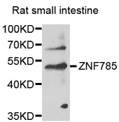 ZNF785 Antibody - Western blot analysis of extracts of rat small intestine, using ZNF785 antibody at 1:1000 dilution. The secondary antibody used was an HRP Goat Anti-Rabbit IgG (H+L) at 1:10000 dilution. Lysates were loaded 25ug per lane and 3% nonfat dry milk in TBST was used for blocking. An ECL Kit was used for detection and the exposure time was 90s.