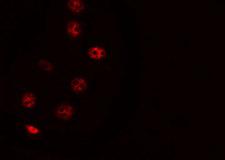 ZNF785 Antibody - Staining HepG2 cells by IF/ICC. The samples were fixed with PFA and permeabilized in 0.1% Triton X-100, then blocked in 10% serum for 45 min at 25°C. The primary antibody was diluted at 1:200 and incubated with the sample for 1 hour at 37°C. An Alexa Fluor 594 conjugated goat anti-rabbit IgG (H+L) Ab, diluted at 1/600, was used as the secondary antibody.