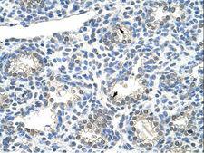 ZNF786 Antibody - ZNF786 antibody ARP39890_T100-EAW80063-ZNF786 (zinc finger protein 786) Antibody was used in IHC to stain formalin-fixed, paraffin-embedded human lung.  This image was taken for the unconjugated form of this product. Other forms have not been tested.