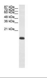 ZNF786 Antibody - Jurkat Cell Lysate.  This image was taken for the unconjugated form of this product. Other forms have not been tested.
