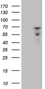 ZNF79 Antibody - HEK293T cells were transfected with the pCMV6-ENTRY control. (Left lane) or pCMV6-ENTRY ZNF79. (Right lane) cDNA for 48 hrs and lysed. Equivalent amounts of cell lysates. (5 ug per lane) were separated by SDS-PAGE and immunoblotted with anti-ZNF79. (1:2000)