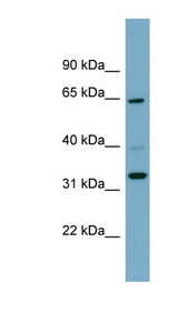 ZNF791 Antibody - ZNF791 antibody Western blot of Fetal Spleen lysate. This image was taken for the unconjugated form of this product. Other forms have not been tested.