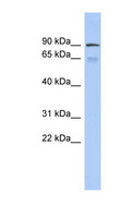 ZNF791 Antibody - ZNF791 antibody Western blot of Fetal Thymus lysate. This image was taken for the unconjugated form of this product. Other forms have not been tested.