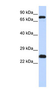 ZNF799 Antibody - ZNF799 antibody Western blot of HeLa lysate. This image was taken for the unconjugated form of this product. Other forms have not been tested.
