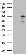 ZNF8 Antibody - HEK293T cells were transfected with the pCMV6-ENTRY control. (Left lane) or pCMV6-ENTRY ZNF8. (Right lane) cDNA for 48 hrs and lysed