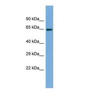 ZNF8 Antibody - Western blot of Human COLO205. ZNF8 antibody dilution 1.0 ug/ml.  This image was taken for the unconjugated form of this product. Other forms have not been tested.