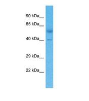 ZNF805 Antibody - Western blot of Human Lung Tumor. ZNF805 antibody dilution 1.0 ug/ml.  This image was taken for the unconjugated form of this product. Other forms have not been tested.