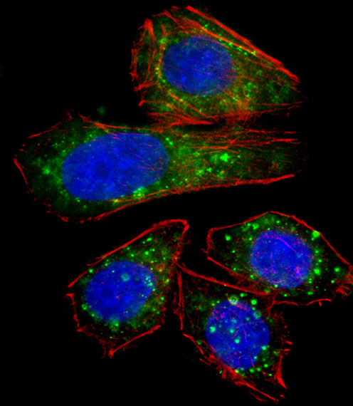 ZNF81 Antibody - Fluorescent confocal image of U251 cell stained with ZNF81 Antibody. U251 cells were fixed with 4% PFA (20 min), permeabilized with Triton X-100 (0.1%, 10 min), then incubated with ZNF81 primary antibody (1:25, 1 h at 37°C). For secondary antibody, Alexa Fluor 488 conjugated donkey anti-rabbit antibody (green) was used (1:400, 50 min at 37°C). Cytoplasmic actin was counterstained with Alexa Fluor 555 (red) conjugated Phalloidin (7units/ml, 1 h at 37°C). Nuclei were counterstained with DAPI (blue) (10 ug/ml, 10 min). ZNF81 immunoreactivity is localized to Vesicles significantly and Cytoplasm weakly.