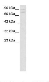 ZNF81 Antibody - Jurkat Cell Lysate.  This image was taken for the unconjugated form of this product. Other forms have not been tested.