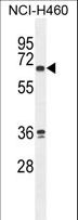 ZNF813 Antibody - ZNF813 Antibody western blot of NCI-H460 cell line lysates (35 ug/lane). The ZNF813 antibody detected the ZNF813 protein (arrow).