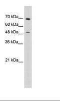 ZNF821 Antibody - Jurkat Cell Lysate.  This image was taken for the unconjugated form of this product. Other forms have not been tested.